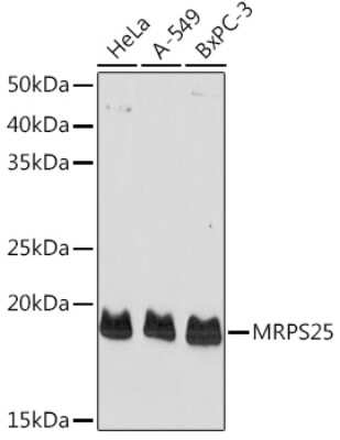 Western Blot: MRPS25 Antibody [NBP3-04167] - Western blot analysis of extracts of various cell lines, using MRPS25 Rabbit pAb (NBP3-04167) at 1:1000 dilution. Secondary antibody: HRP Goat Anti-Rabbit IgG (H+L) at 1:10000 dilution. Lysates/proteins: 25ug per lane. Blocking buffer: 3% nonfat dry milk in TBST. Detection: ECL Basic Kit. Exposure time: 180s.